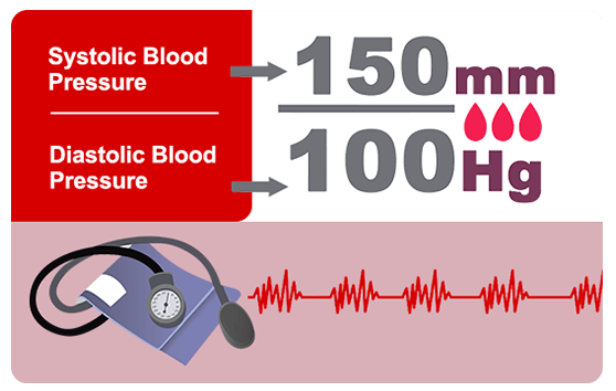 Blood pressure measure hypertension