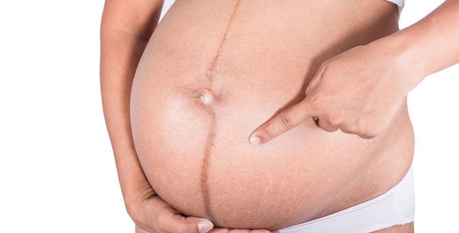 5 tips to prevent dark skin in pregnancy